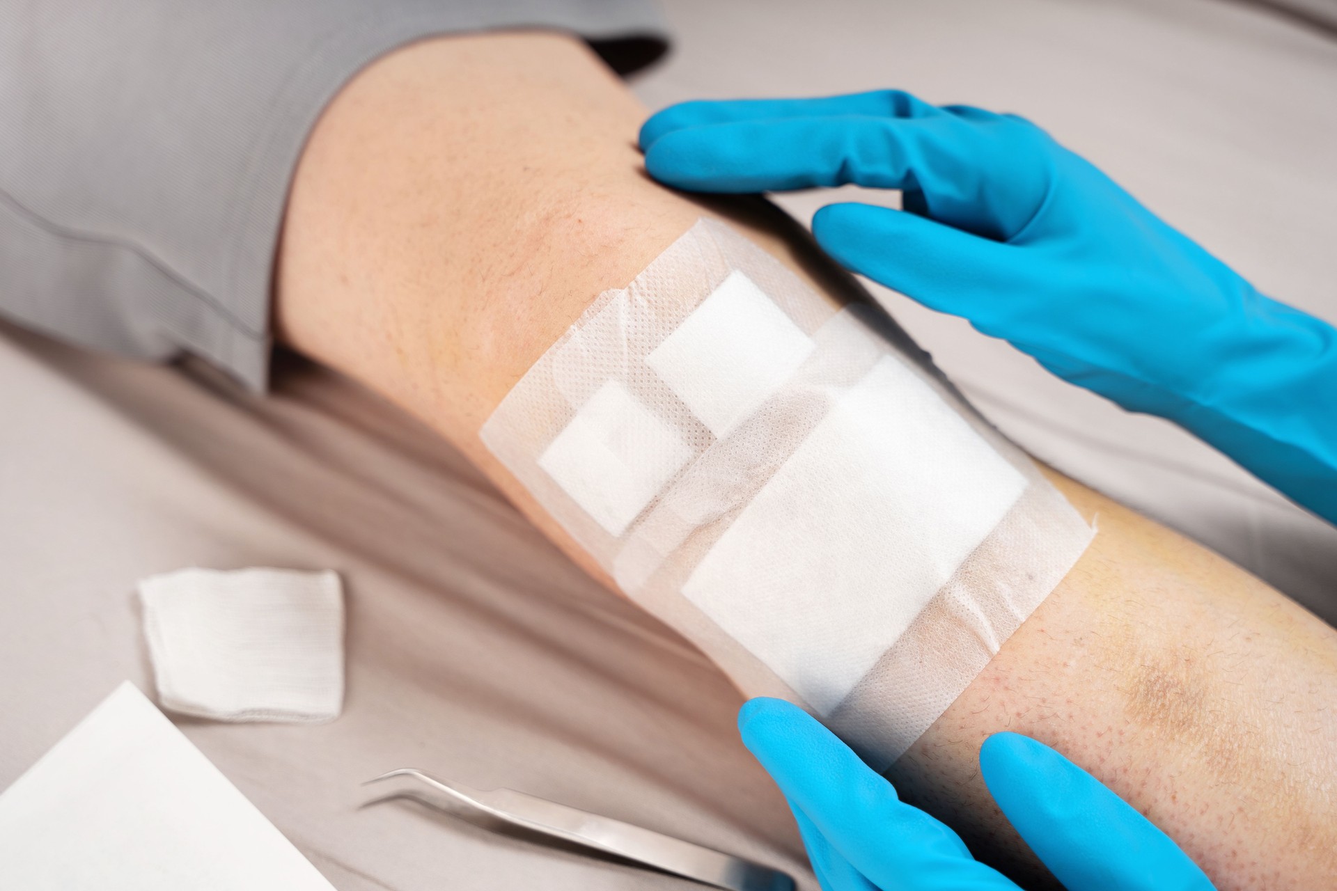 Medical professional hands in gloves change bandage on a patient bruised knee using sterile tweezers. Concept of clinical wound care, hygiene standards and precision in outpatient orthopedic treatment